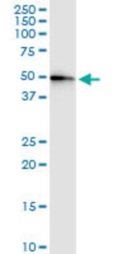 CENPJ, Rabbit anti-Human, Polyclonal Antibody, Abnova 100&mu;L; Unconjugated:Antibodies,