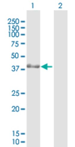 PBK, Rabbit anti-Human, Polyclonal Antibody, Abnova 100 &mu;L | Buy Online | Abnova | Fisher Scientific
