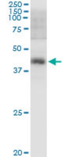 PBK, Rabbit anti-Human, Polyclonal Antibody, Abnova 100 &mu;L | Buy Online | Abnova | Fisher Scientific