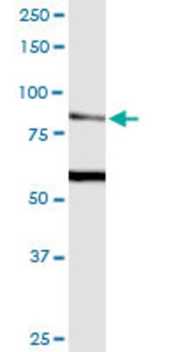 TRPV5, Mouse anti-Human, Clone: 2A6, Abnova 100&mu;g; Unconjugated:Antibodies,