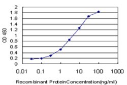 TRPV5, Mouse anti-Human, Clone: 2A6, Abnova 100&mu;g; Unconjugated:Antibodies,