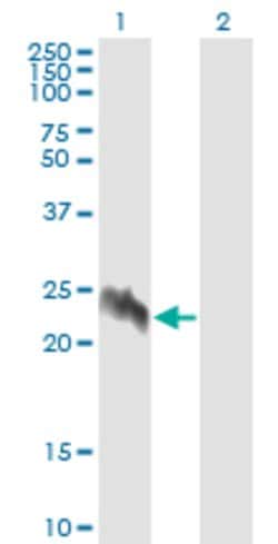 EIF5A2, Mouse anti-Human, Clone: 1E7, Abnova 100&mu;g; Unconjugated:Antibodies,
