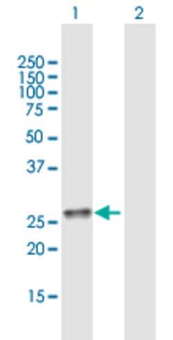 C11orf17, Mouse anti-Human, Polyclonal Antibody, Abnova 50&mu;g; Unconjugated:Antibodies,