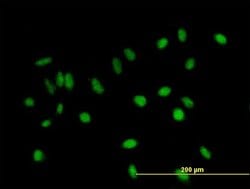 C11orf17, Mouse anti-Human, Polyclonal Antibody, Abnova 50&mu;g; Unconjugated:Antibodies,
