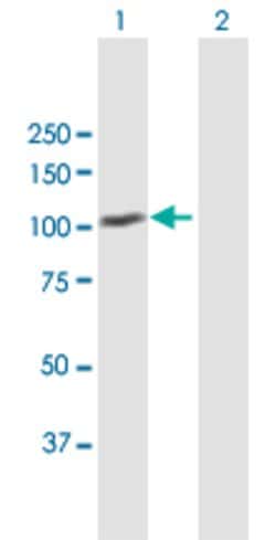 MDM1, Mouse anti-Human, Polyclonal Antibody, Abnova 50 &mu;g | Buy Online | Abnova | Fisher Scientific