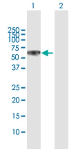 DPYSL5, Rabbit anti-Human, Polyclonal Antibody, Abnova 100&mu;L; Unconjugated:Antibodies,