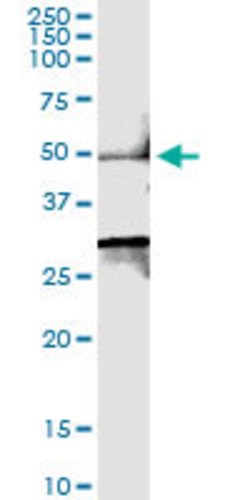 SMYD2, Rabbit anti-Human, Polyclonal Antibody, Abnova 100&mu;L; Unconjugated:Antibodies,