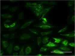 NT5M, Mouse anti-Human, Clone: 3E2, Abnova 100&mu;g; Unconjugated:Antibodies,
