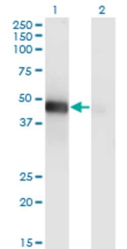 LHX9, Mouse anti-Human, Clone: 1D8, Abnova 100&mu;g; Unconjugated:Antibodies,
