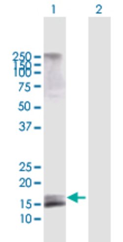 AGTRAP, Rabbit anti-Human, Polyclonal Antibody, Abnova 100 &mu;L | Buy Online | Abnova | Fisher Scientific