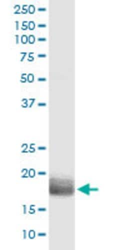 AGTRAP, Rabbit anti-Human, Polyclonal Antibody, Abnova 100 &mu;L | Buy Online | Abnova | Fisher Scientific