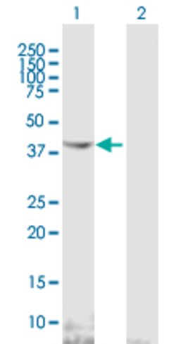 NDRG2, Mouse anti-Human, Polyclonal Antibody, Abnova 50&mu;L; Unconjugated:Antibodies,