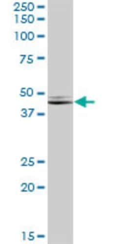 NDRG2, Mouse anti-Human, Polyclonal Antibody, Abnova 50&mu;L; Unconjugated:Antibodies,