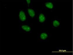 GATAD2B, Mouse anti-Human, Polyclonal Antibody, Abnova 50&mu;g; Unconjugated:Antibodies,