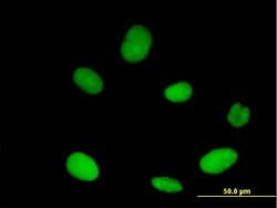 XPO5, Mouse anti-Human, Polyclonal Antibody, Abnova 50&mu;g; Unconjugated:Antibodies,