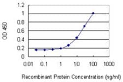LRRN1, Mouse anti-Human, Clone: 3D11, Abnova 100&mu;g; Unconjugated:Antibodies,