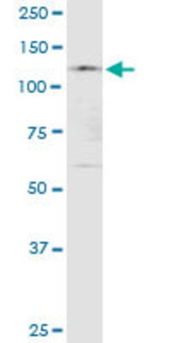 KIAA1967, Rabbit anti-Human, Polyclonal Antibody, Abnova 100&mu;L; Unconjugated:Antibodies,