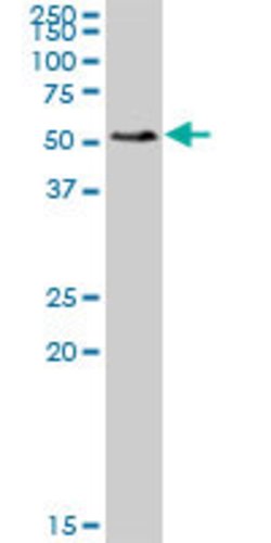 SMAP1, Mouse anti-Human, Polyclonal Antibody, Abnova 50 &mu;g | Buy Online | Abnova | Fisher Scientific