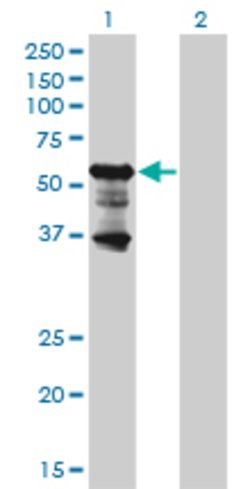 PKNOX2, Mouse anti-Human, Clone: 4B6, Abnova 100&mu;g; Unconjugated:Antibodies,