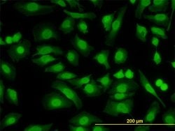 PKNOX2, Mouse anti-Human, Clone: 4B6, Abnova 100&mu;g; Unconjugated:Antibodies,