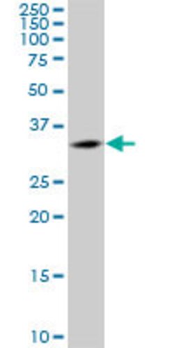 CENPK, Mouse anti-Human, Polyclonal Antibody, Abnova 50&mu;g; Unconjugated:Antibodies,