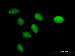 CENPK, Mouse anti-Human, Polyclonal Antibody, Abnova 50&mu;g; Unconjugated:Antibodies,