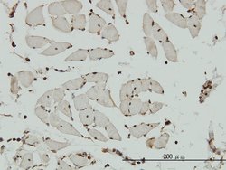 NCAPG, Mouse anti-Human, Clone: 4B1, Abnova 100 &mu;g | Buy Online | Abnova | Fisher Scientific
