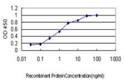 NCAPG, Mouse anti-Human, Clone: 4B1, Abnova 100 &mu;g | Buy Online | Abnova | Fisher Scientific