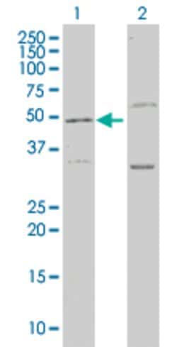LEPRE1, Mouse anti-Human, Clone: 3C7, Abnova 100&mu;g; Unconjugated:Antibodies,