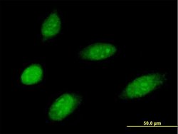 MMS19, Mouse anti-Human, Polyclonal Antibody, Abnova 50&mu;g; Unconjugated:Antibodies,
