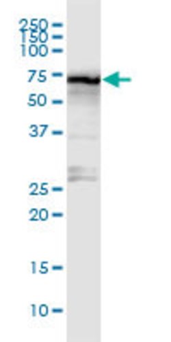 STRA6, Rabbit anti-Human, Polyclonal Antibody, Abnova 100&mu;g; Unconjugated:Antibodies,