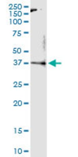 MLST8, Rabbit anti-Human, Polyclonal Antibody, Abnova 100&mu;L; Unconjugated:Antibodies,