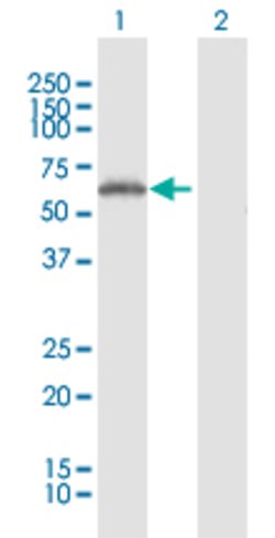 RNF25, Rabbit anti-Human, Polyclonal Antibody, Abnova 100 &mu;L | Buy Online | Abnova | Fisher Scientific