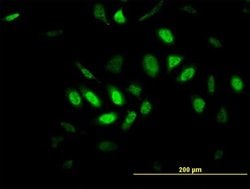 GPR135, Mouse anti-Human, Clone: 1H5, Abnova 100&mu;g; Unconjugated:Antibodies,
