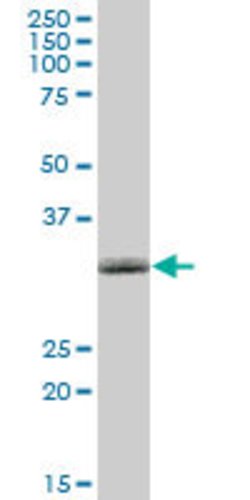 NMNAT1, Mouse anti-Human, Polyclonal Antibody, Abnova 50&mu;g; Unconjugated:Antibodies,