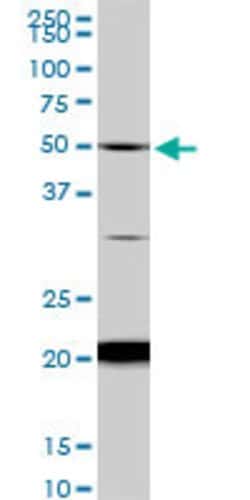 NADK, Mouse anti-Human, Clone: 5F4, Abnova 100&mu;g; Unconjugated:Antibodies,