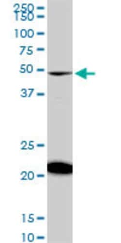 NADK, Mouse anti-Human, Clone: 5F4, Abnova 100&mu;g; Unconjugated:Antibodies,