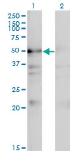 NADK, Mouse anti-Human, Clone: 5F4, Abnova 100&mu;g; Unconjugated:Antibodies,