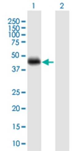 CRELD1, Rabbit anti-Human, Polyclonal Antibody, Abnova 100&mu;L; Unconjugated:Antibodies,