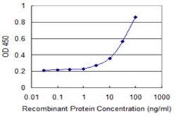 BIRC7, Mouse anti-Human, Clone: 3H1, Abnova 100&mu;g; Unconjugated:Antibodies,