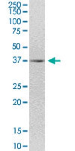 FLJ22167, Mouse anti-Human, Polyclonal Antibody, Abnova 50&mu;g; Unconjugated:Antibodies,