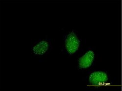 SAP30L, Mouse anti-Human, Polyclonal Antibody, Abnova 50&mu;g; Unconjugated:Antibodies,