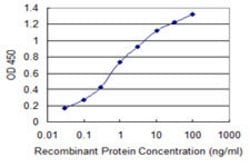 PIP4K2C, Mouse anti-Human, Clone: 3E10, Abnova 100 &mu;g | Buy Online | Abnova | Fisher Scientific