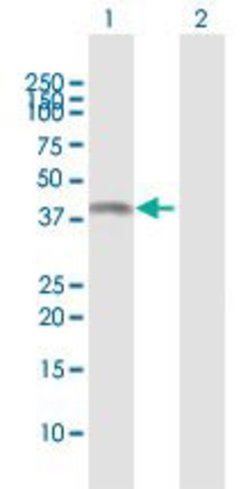 ASRGL1, Rabbit anti-Human, Polyclonal Antibody, Abnova 100&mu;L; Unconjugated:Antibodies,