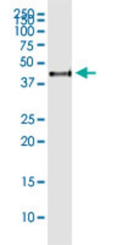 ASRGL1, Rabbit anti-Human, Polyclonal Antibody, Abnova 100&mu;L; Unconjugated:Antibodies,