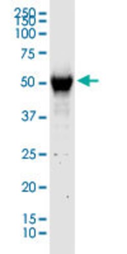 C13orf18, Rabbit anti-Human, Polyclonal Antibody, Abnova 100&mu;g; Unconjugated:Antibodies,
