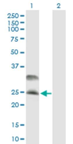 DNAJC5, Mouse anti-Human, Polyclonal Antibody, Abnova 50&mu;g; Unconjugated:Antibodies,