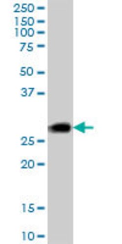 DNAJC5, Mouse anti-Human, Polyclonal Antibody, Abnova 50&mu;g; Unconjugated:Antibodies,