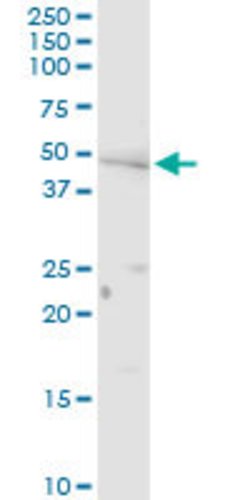 PNPLA3, Rabbit anti-Human, Polyclonal Antibody, Abnova 100&mu;g; Unconjugated:Antibodies,