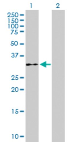 WDR61, Mouse anti-Human, Polyclonal Antibody, Abnova 50&mu;g; Unconjugated:Antibodies,